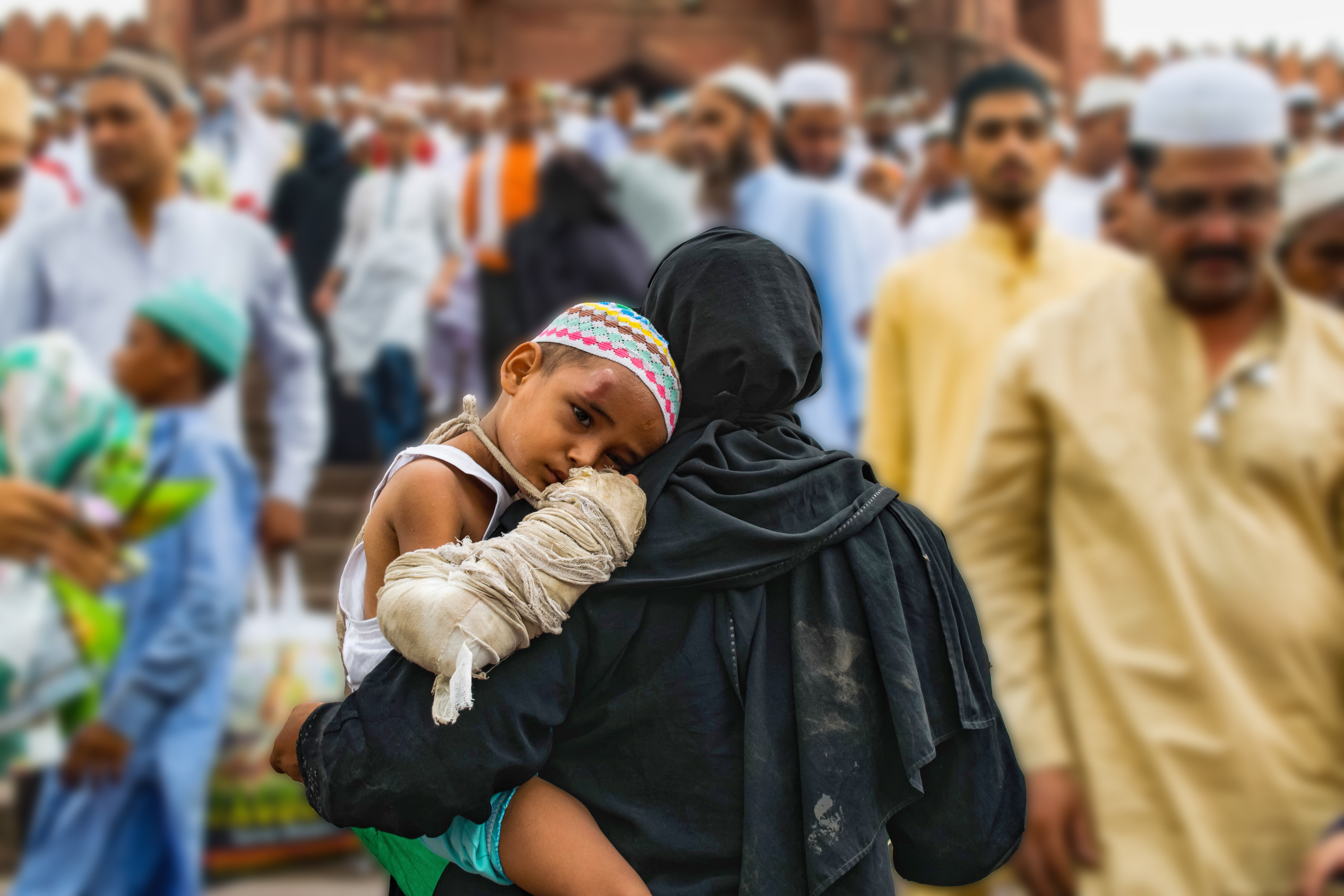 woman with baby with swollen head